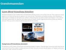 Tablet Screenshot of granulomaannulare.net